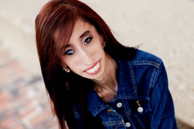Bild von Lizzie Velasquez